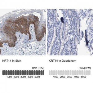 Anti-KRT14 antibody produced in rabbit 