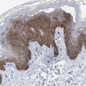 Anti-KRT14 antibody produced in rabbit 