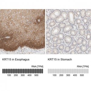 Anti-KRT15 antibody produced in rabbit 
