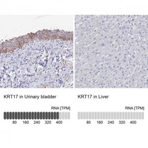 Anti-KRT17 antibody produced in rabbit 