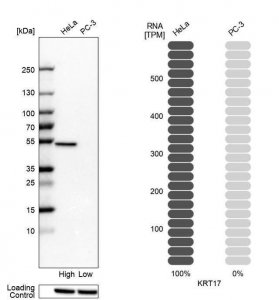 Anti-KRT17 antibody produced in rabbit 