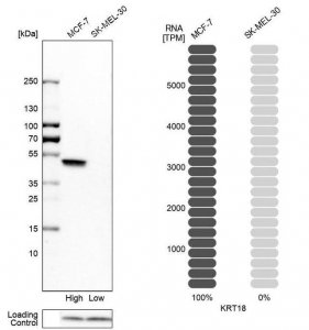 Anti-KRT18 antibody produced in rabbit 