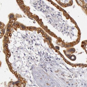 Anti-KRT18 antibody produced in rabbit 