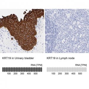Anti-KRT19 antibody produced in rabbit 