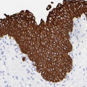 Anti-KRT19 antibody produced in rabbit 