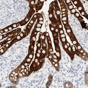 Anti-KRT20 antibody produced in rabbit 