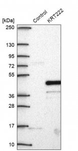 Anti-KRT222 antibody produced in rabbit HPA054586-100UL