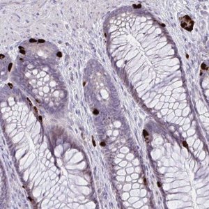 Anti-KRT222 antibody produced in rabbit HPA054586-100UL