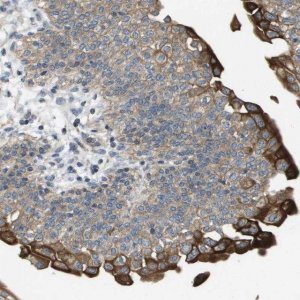 Anti-KRT23 antibody produced in rabbit 
