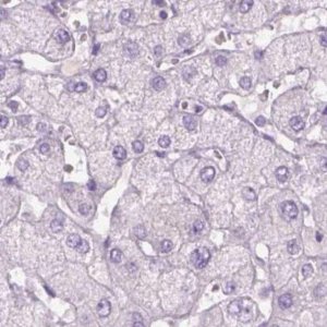 Anti-KRT25 antibody produced in rabbit 