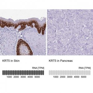 Anti-KRT5 antibody produced in rabbit 