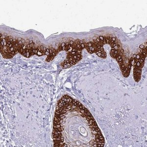 Anti-KRT5 antibody produced in rabbit 