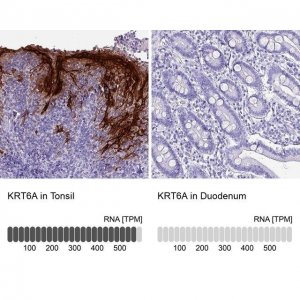 Anti-KRT6A antibody produced in rabbit 