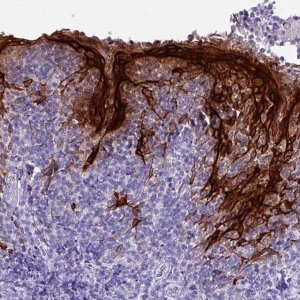 Anti-KRT6A antibody produced in rabbit 
