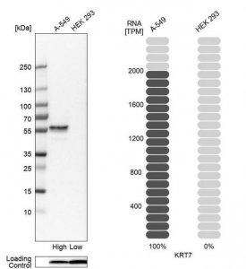 Anti-KRT7 antibody produced in rabbit 