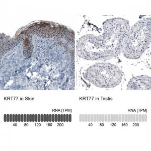 Anti-KRT77 antibody produced in rabbit 