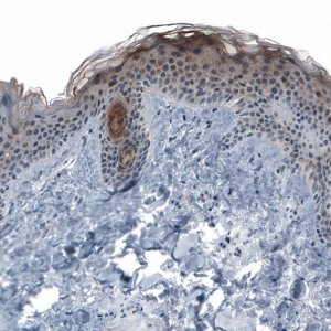 Anti-KRT77 antibody produced in rabbit 