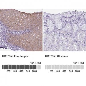 Anti-KRT78 antibody produced in rabbit 