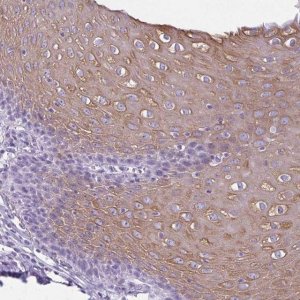 Anti-KRT78 antibody produced in rabbit 