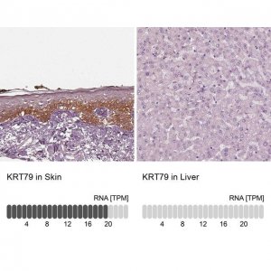 Anti-KRT79 antibody produced in rabbit 