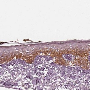 Anti-KRT79 antibody produced in rabbit 