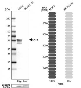 Anti-KRT8 antibody produced in rabbit HPA049866-100UL
