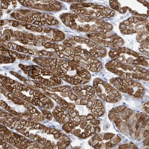 Anti-KRT8 antibody produced in rabbit HPA049866-100UL