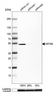 Anti-KRT80 antibody produced in rabbit HPA077918-100UL