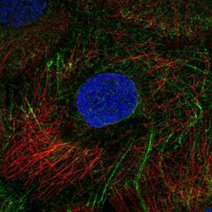 Anti-KRT80 antibody produced in rabbit HPA077918-100UL