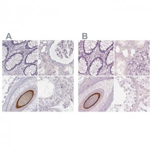 Anti-KRT82 antibody produced in rabbit 