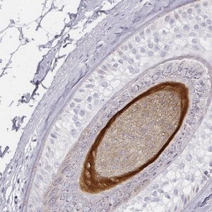 Anti-KRT82 antibody produced in rabbit 