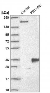 Anti-KRTAP27-1 antibody produced in rabbit 
