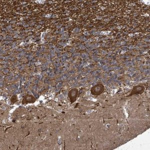 Anti-KRTAP27-1 antibody produced in rabbit 