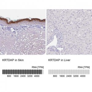 Anti-KRTDAP antibody produced in rabbit 