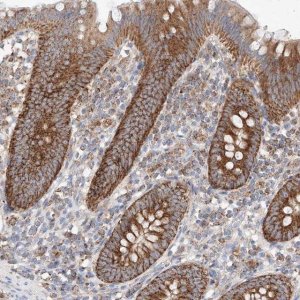 Anti-KTI12 antibody produced in rabbit 