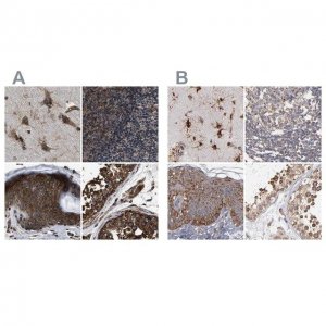 Anti-KTN1 antibody produced in rabbit 