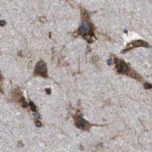 Anti-KTN1 antibody produced in rabbit 
