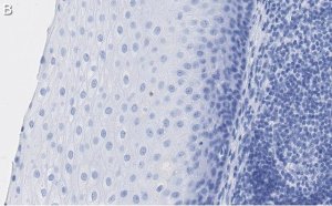 Anti-L-amino acid oxidase Antibody, clone 4O11 ZooMAb Rabbit Monoclonal 