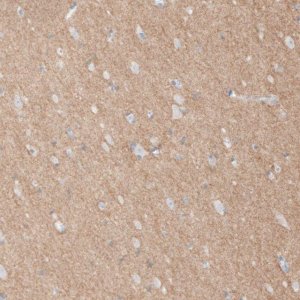 Anti-L1CAM antibody produced in rabbit 