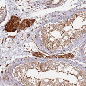 Anti-LACC1 antibody produced in rabbit 