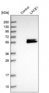 Anti-LACE1 antibody produced in rabbit 