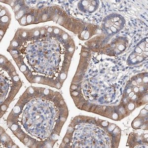 Anti-LACE1 antibody produced in rabbit 