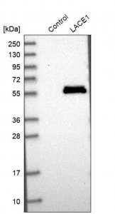 Anti-LACE1 antibody produced in rabbit HPA030659-100UL