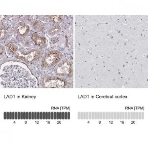 Anti-LAD1 antibody produced in rabbit 