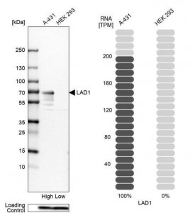 Anti-LAD1 antibody produced in rabbit 