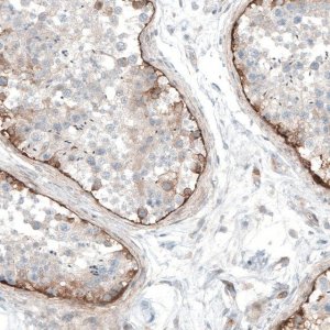 Anti-LAMA1 antibody produced in rabbit 