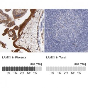 Anti-LAMC1 antibody produced in rabbit 