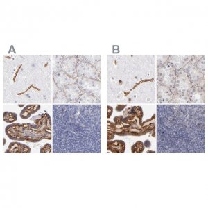Anti-LAMC1 antibody produced in rabbit 