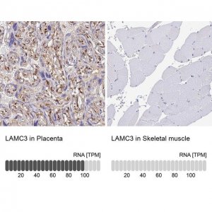 Anti-LAMC3 antibody produced in rabbit 