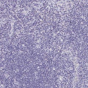 Anti-LAMC3 antibody produced in rabbit 
